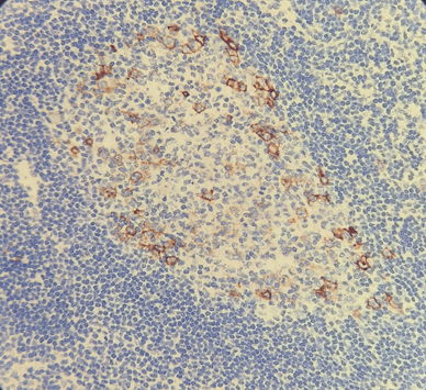 CD30 ANTIBODY