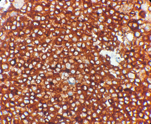 MART-1/MELAN A ANTIBODY