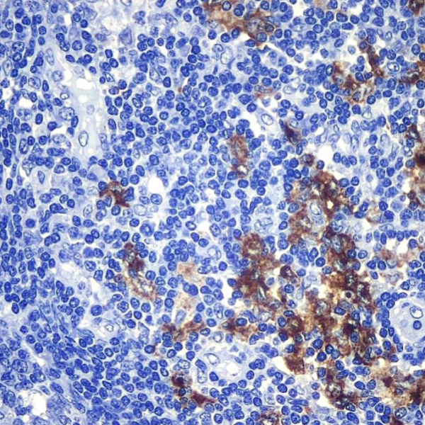 ANTIBODY À LONG TERME