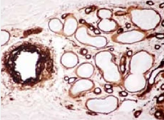 COLLAGÈNE TYPE IV ANTIBODY