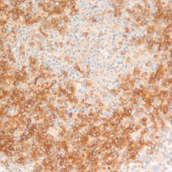 CD123 ANTIBODY