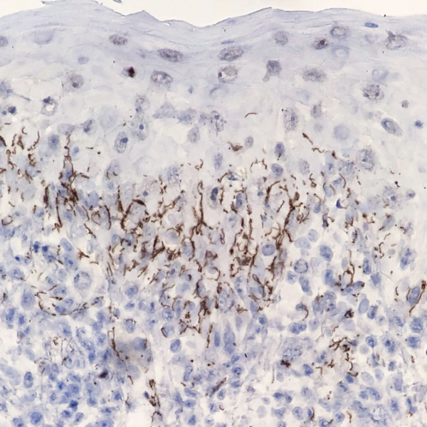 Treponema Pallidum Antibody