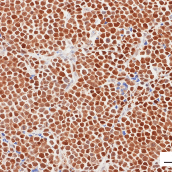 McpyV Large T-Antigen Antibody