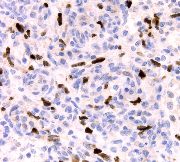 Human Herpesvirus HHV8