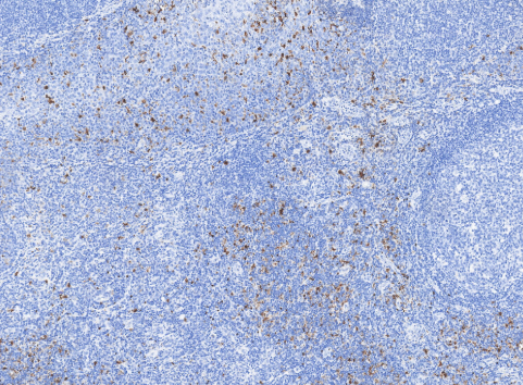 S100 ANTIBODY