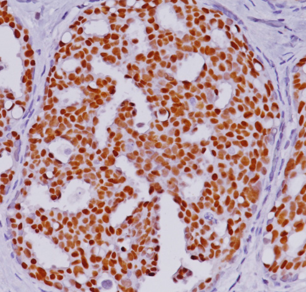 OESTROGEN REZEPTOR ANTIBODY